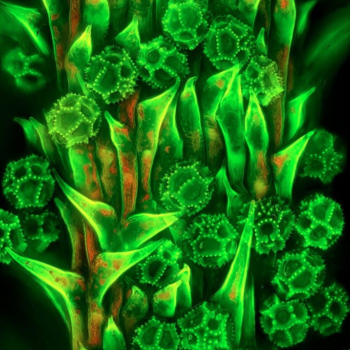 Mikrofoto von Ferkelkraut, Pollen, Blauanregung, 1,  Bildbreite = 0,4 mm